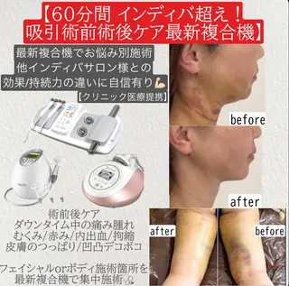 医療提携術後ケア痩身 専門サロン池袋のエステ・リラクイメージ