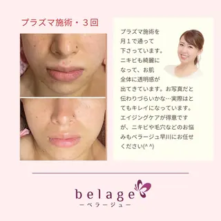 ベラージュ【美背中・ 美尻・フェイシャル】のエステ・リラクイメージ