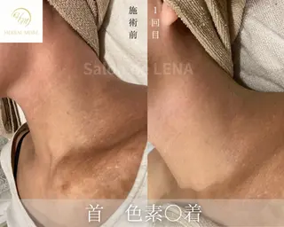 ハーブピーリング・毛穴ケア専門サロンSalon de LENA 栄店所属・ハーブピーリング専門 サロンドレナ 白藤のエステ・リラクイメージ