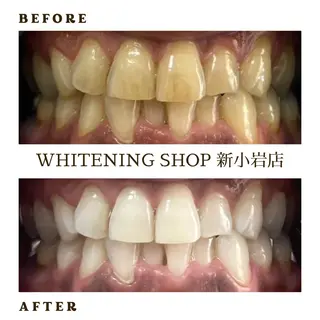 メンズ ホワイトニング ショップ新小岩店のその他イメージ