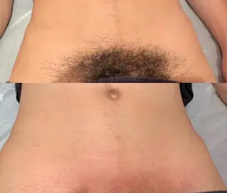 メンズ プライベートサロンBRAG所属・プライベートサロン BRAG🏠男女OKのエステ・リラクイメージ