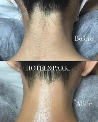 HOTEL&PARK . ワックス脱毛のエステ・リラクイメージ