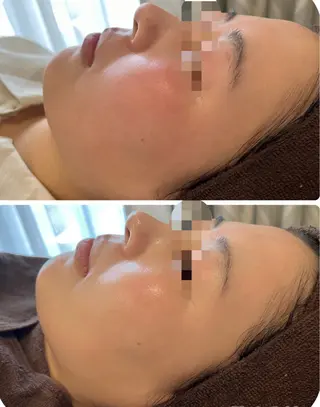 【リベルハーブピーリング認定店】敏感肌・美白脱毛専門店Dione立川店所属・Dione 立川店のエステ・リラクイメージ
