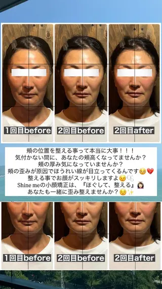💎後悔させない小顔 矯正💎イトヤマ🌱のエステ・リラクイメージ