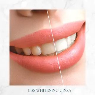 ミディアム メンズ カラー LBSホワイトニング 銀座店💎公式のその他イメージ