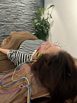 美容鍼灸整体サロンBeauJu所属・小顔矯/美容鍼/鍼灸 BeauJuのその他イメージ