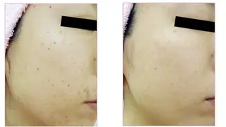 LiZA エステティックサロンのエステ・リラクイメージ