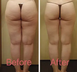 BELINDA銀座店 ✨痩身エステサロン✨のエステ・リラクイメージ