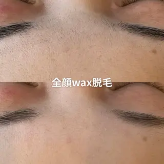 EST BEAUTY所属・顔専門ワックス脱毛/ ハーブピーリングのエステ・リラクイメージ