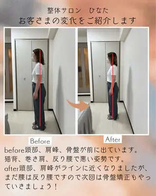 整体サロン　ひなた~HINATA~ 　京阪七条　京都店所属・肩こり反り腰改善専門 筋膜✨整体ひなたのエステ・リラクイメージ