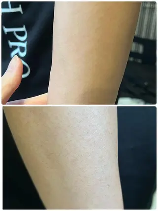 クラスペディア脱毛 ・フェイシャル専門店のエステ・リラクイメージ