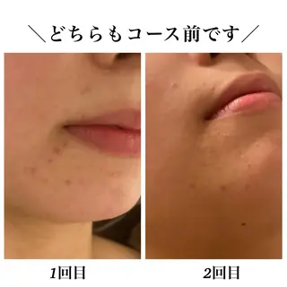 Bellesthe (ベルエステ)のエステ・リラクイメージ