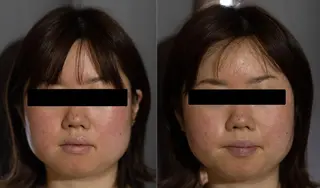 中山 秀展のエステ・リラクイメージ