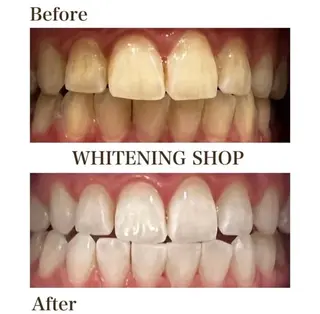 ホワイトニングショップ伊丹店所属・ホワイトニング ショップ伊丹店のその他イメージ