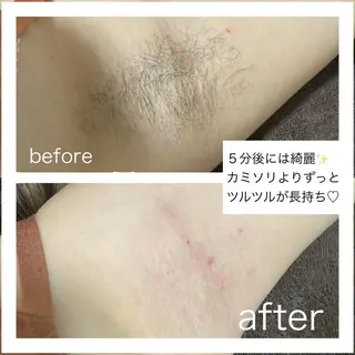Private salon aloalo所属・佐野 友海恵のエステ・リラクイメージ
