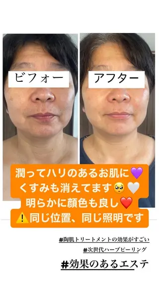 肌育脱毛サロン LikoLinaのその他イメージ