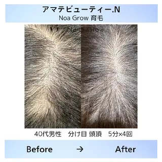 メンズ 痩身小顔専門 アマテ ビューティー.Nのエステ・リラクイメージ