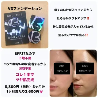 未病ケアサロン EMINY所属・未病ケアサロン EMINY☺︎勝俣のエステ・リラクイメージ