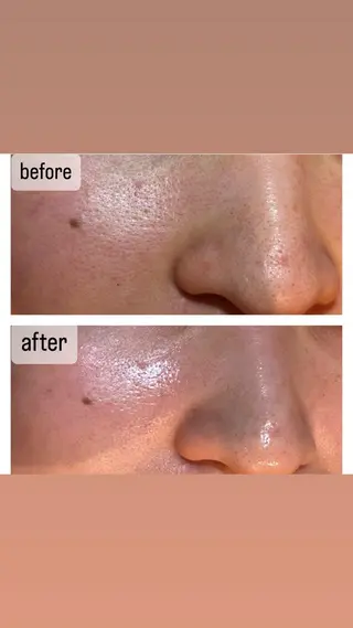 駒月 明日香のネイルデザイン