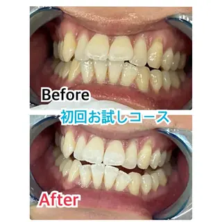 プラチナムビューティー柏所属・【歯科提携】柏ホワイ トニングスタイルのその他イメージ