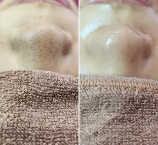 Anacia Beauty Salon所属・美肌脱毛&毛穴専門 Anaciaのエステ・リラクイメージ