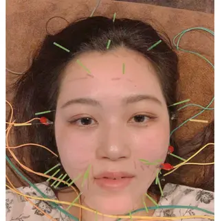 美容鍼灸サロン LOMIHARIのエステ・リラクイメージ