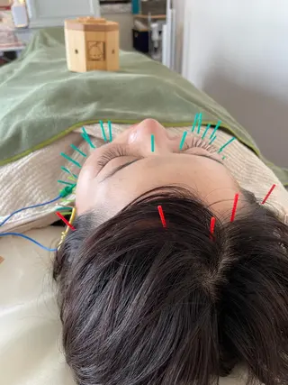 小顔美容鍼専門サロン 渋谷YZのエステ・リラクイメージ