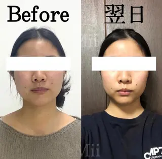 小顔と ヘッドスパのお店のエステ・リラクイメージ