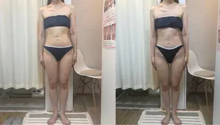 脱毛｜肌質改善｜ ROOM.Sのエステ・リラクイメージ