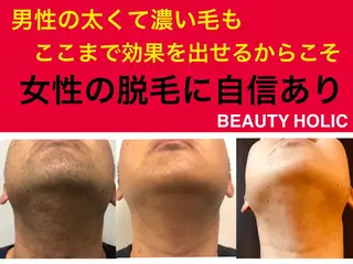 ニキビ・ 肌荒れ専門店のエステ・リラクイメージ