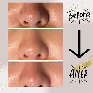 ピーリング専門店 Belluteのエステ・リラクイメージ