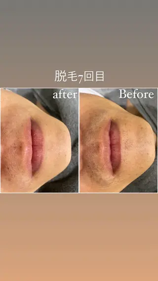 毛穴洗浄・痩身・脱毛 /アルカンジュのエステ・リラクイメージ