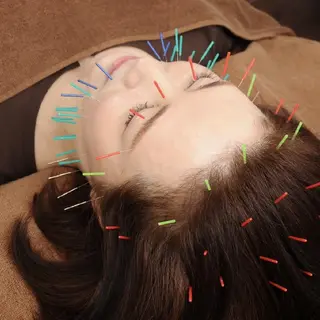 Spring鍼灸院所属・Spring鍼灸院 ✨首肩こり、腰痛に!のエステ・リラクイメージ
