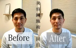 鍼灸整骨院Refine所属・鍼灸 Refineのその他イメージ