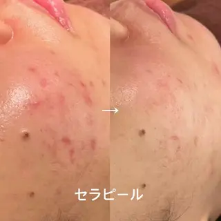 【LEPUS】 nishimoriのエステ・リラクイメージ