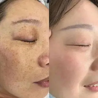 Einami 美肌痩身サロンのエステ・リラクイメージ