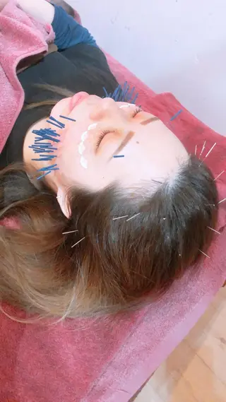 美容鍼灸女性専用 りんご鍼灸治療院のその他イメージ