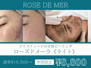 肌質改善サロン BestBelleのエステ・リラクイメージ