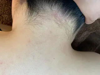 脱毛SALON RaYNiCKのエステ・リラクイメージ