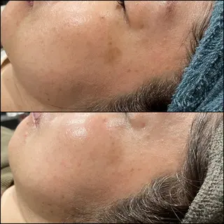 LiZA エステティックサロンのエステ・リラクイメージ