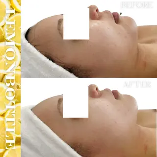 Liam《美肌管理/ 3D小顔/脂肪ケア》のその他イメージ