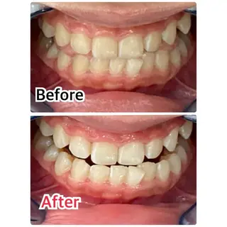 プラチナムビューティー柏所属・【歯科提携】柏ホワイ トニングスタイルのその他イメージ