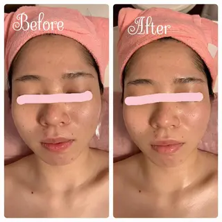 透明感の肌Lino malieのエステ・リラクイメージ