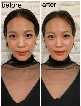 美容鍼 IKEZAKIのエステ・リラクイメージ