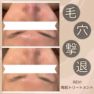 Meow！～トラブル肌専門ピーリング＆脱毛サロン～所属・トラブル肌改善🏥 Meow！🫧🫧のエステ・リラクイメージ