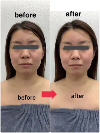 メディカルサロンドオフ所属・ハリサロンドオフ 美容鍼灸×小顔整体のエステ・リラクイメージ