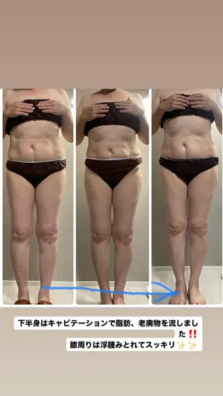 エステ／ネイル/脱毛 R.Msalonのネイルデザイン