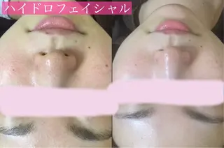 eclair エクレイルのエステ・リラクイメージ