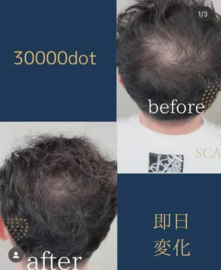 メンズ W eye+東口店/ SCALP INKのマツエク・マツパデザイン
