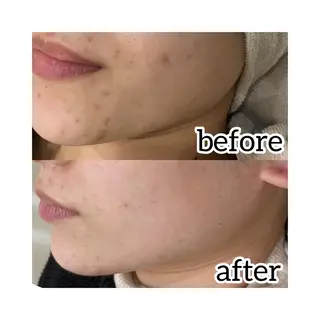 laluna saki...のその他イメージ